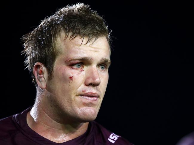 SYDNEY, AUSTRALIA - AUGUST 17: Jake Trbojevic  of the Sea Eagles looks dejected after defeat during the round 23 NRL match between the Manly Sea Eagles and the Gold Coast Titans at Lottoland on August 17, 2018 in Sydney, Australia. (Photo by Mark Kolbe/Getty Images)