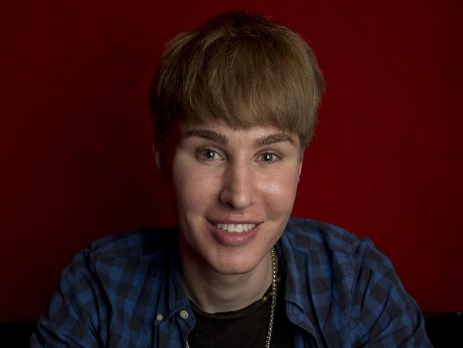 This Justin Bieber fan spent $100,000 on plastic surgery to look like his idol.