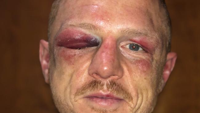 Australia’s 2012 London Olympics boxing captain Luke Jackson after suffering a world-title loss to Carl Frampton in 2018.