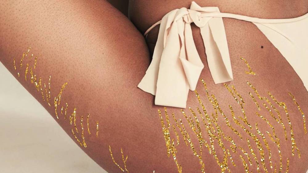 This Woman Uses Glitter To Turn Stretch Marks Into Amazing Art Bodysoul
