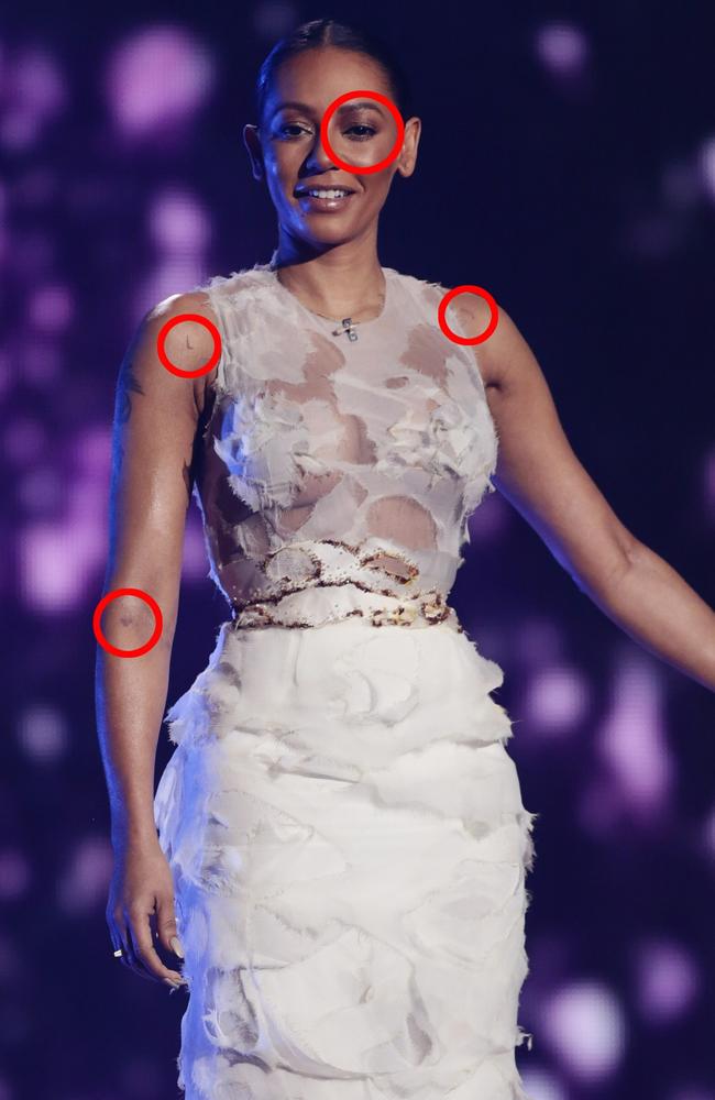 Mel B appeared on X Factor with visible bruises back in 2014. Picture: Dymond/Syco/Thames