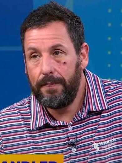 Adam Sandler showed up to GMA looking a bit worse for wear.