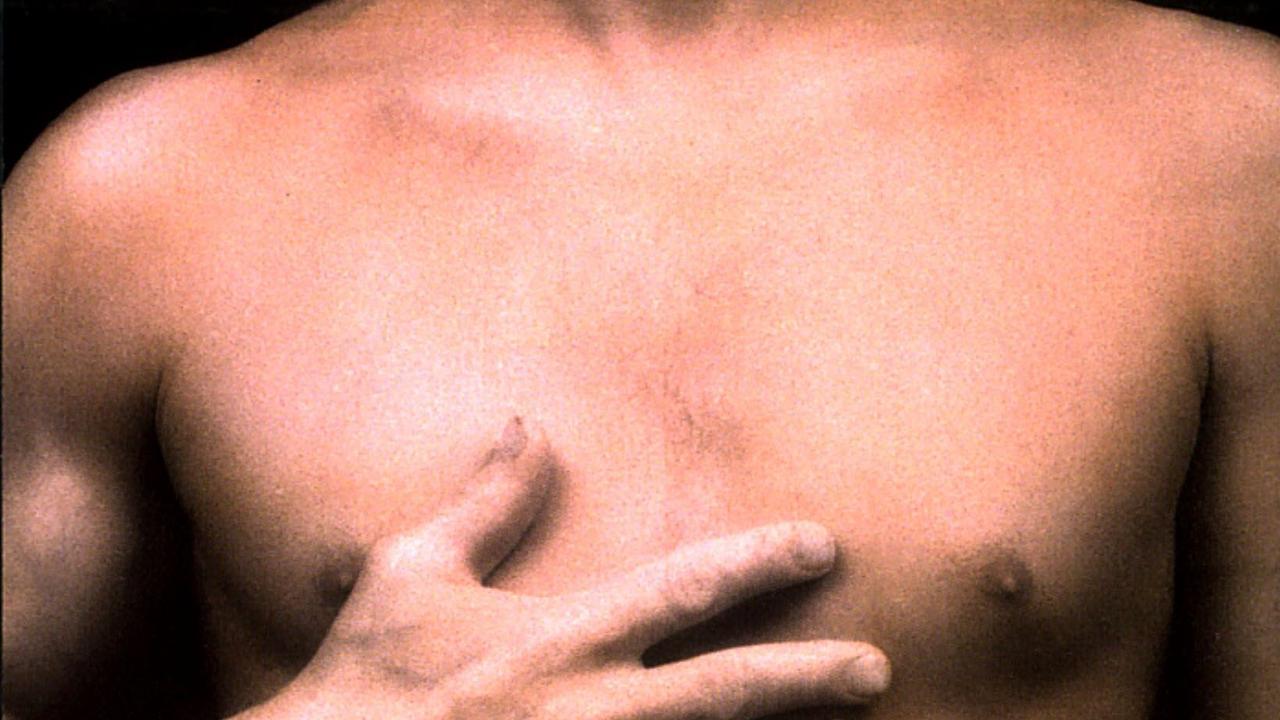 Johnson &amp; Johnson failed to warn that its drug, Risperdal, could cause men to grow breasts.