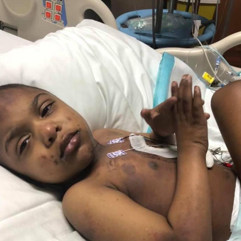 Randa is fundraising to help cover Jaxen’s medical costs. Picture: Facebook / Randa Ragland