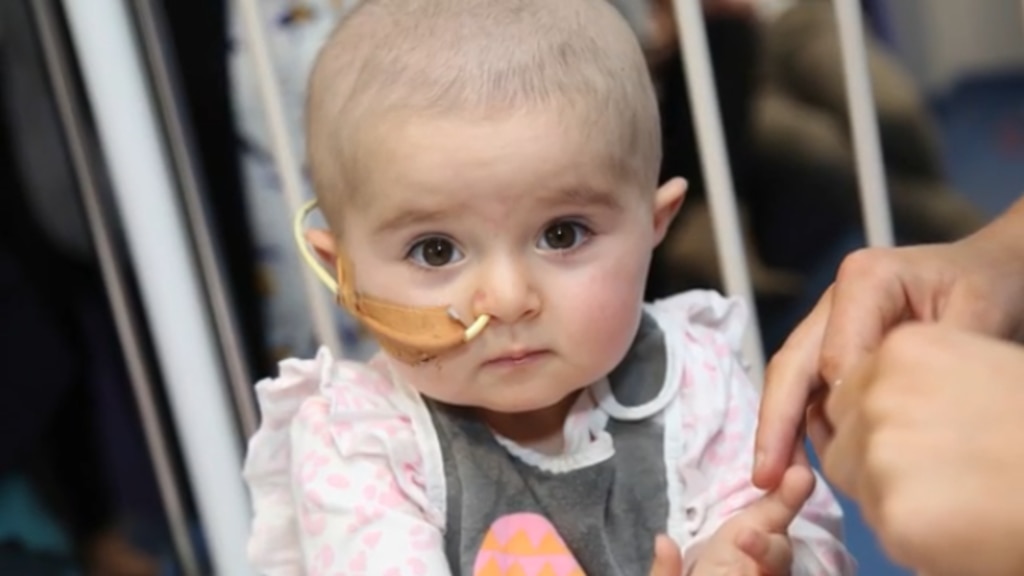 Ellie Caterjian had a nasal gastric tube for feeding.