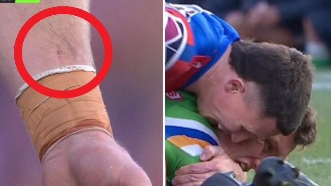 NRL star makes stunning bite accusation