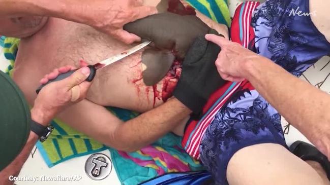 Shark bites man on the stomach and won't let go