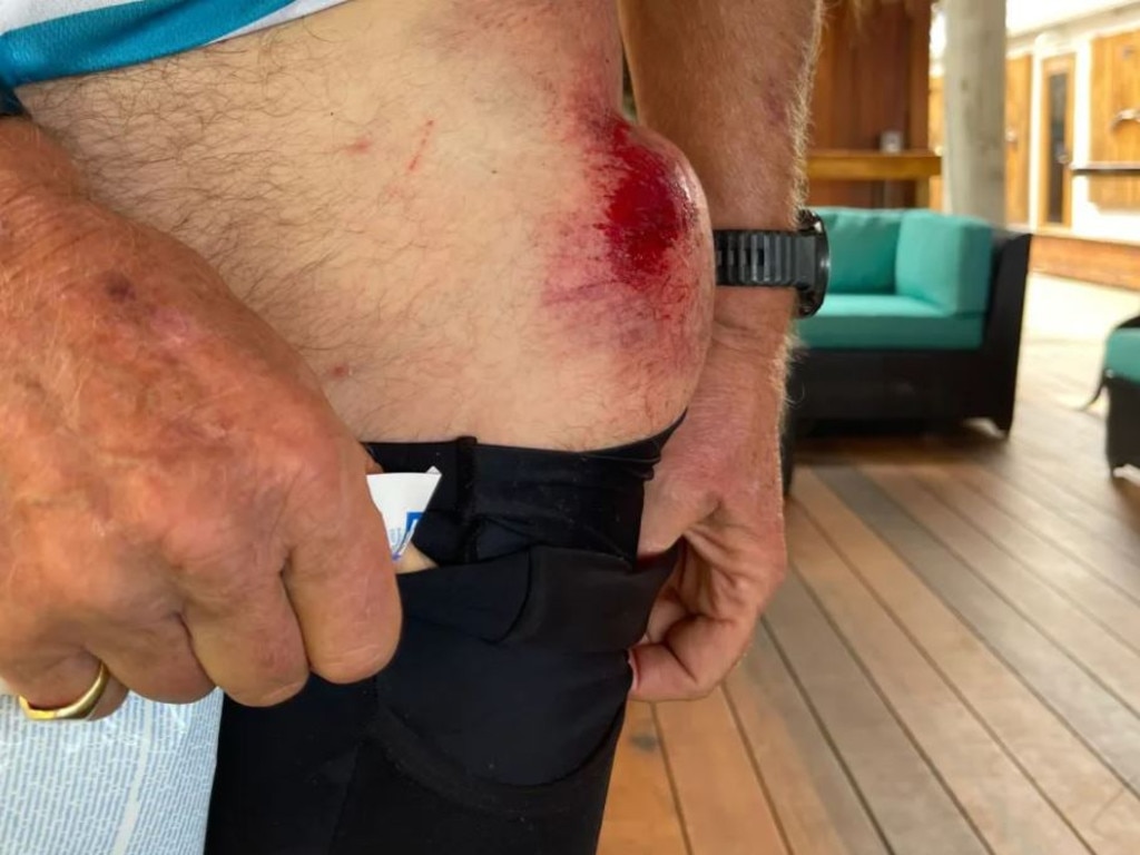 Richard Branson suffers 'nasty' injuries in cycling accident, World News