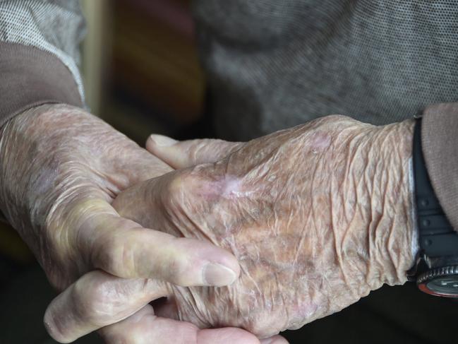 ONE STEP AHEAD: A Stepping On program, aimed at elderly fall prevention, is being held in Alstonville starting next month.