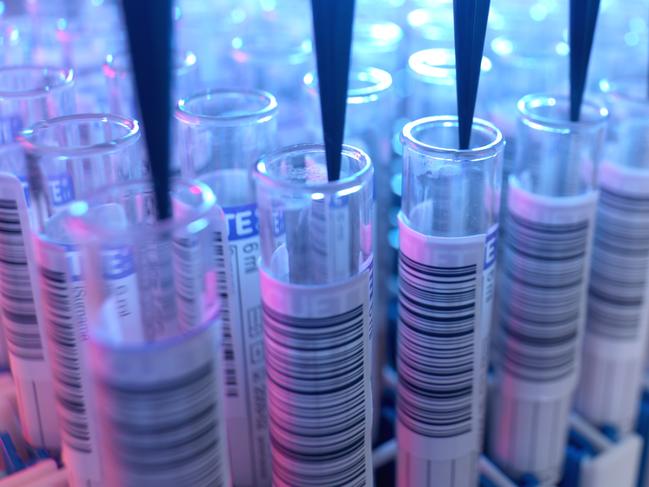 A cure for HIV could be on the horizon. Picture: Getty Images