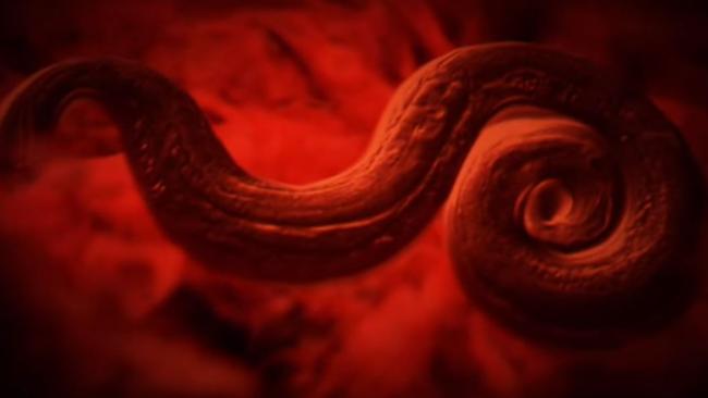 Rat lungworm cases have broken out in Hawaii causing serious concern among health experts.