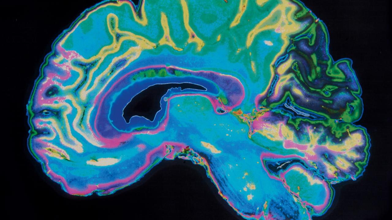 These tiny changes appear in the brain before depression begins