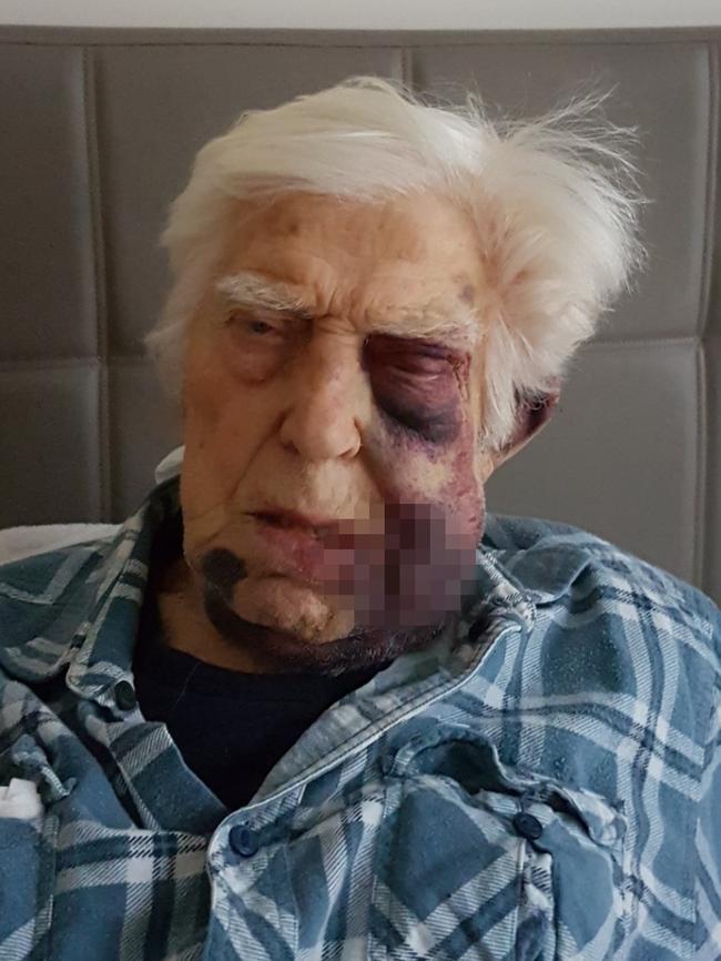 Tom Nemaric, 92, fell while a resident at Bupa Bellarine Lakes in Geelong. Picture: Supplied