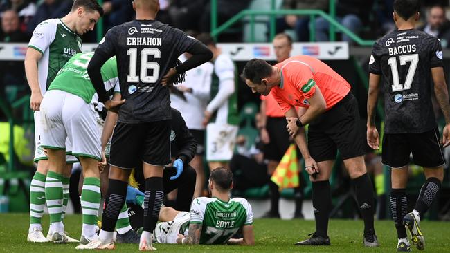 Martin Boyle hasn't played since suffering the knee injury for Hibs. Picture: Getty