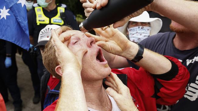 A protester has capsicum spray washed from his eyes. Picture: Daniel Pockett