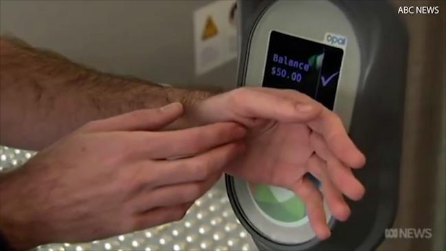 Man has Opal card implanted in his hand