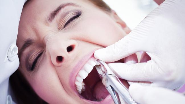 Smiles Inclusive Ltd's boardroom saga has been like pulling teeth. Photo: iStock