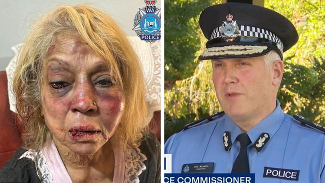 Fury as elderly Aussie beaten in home