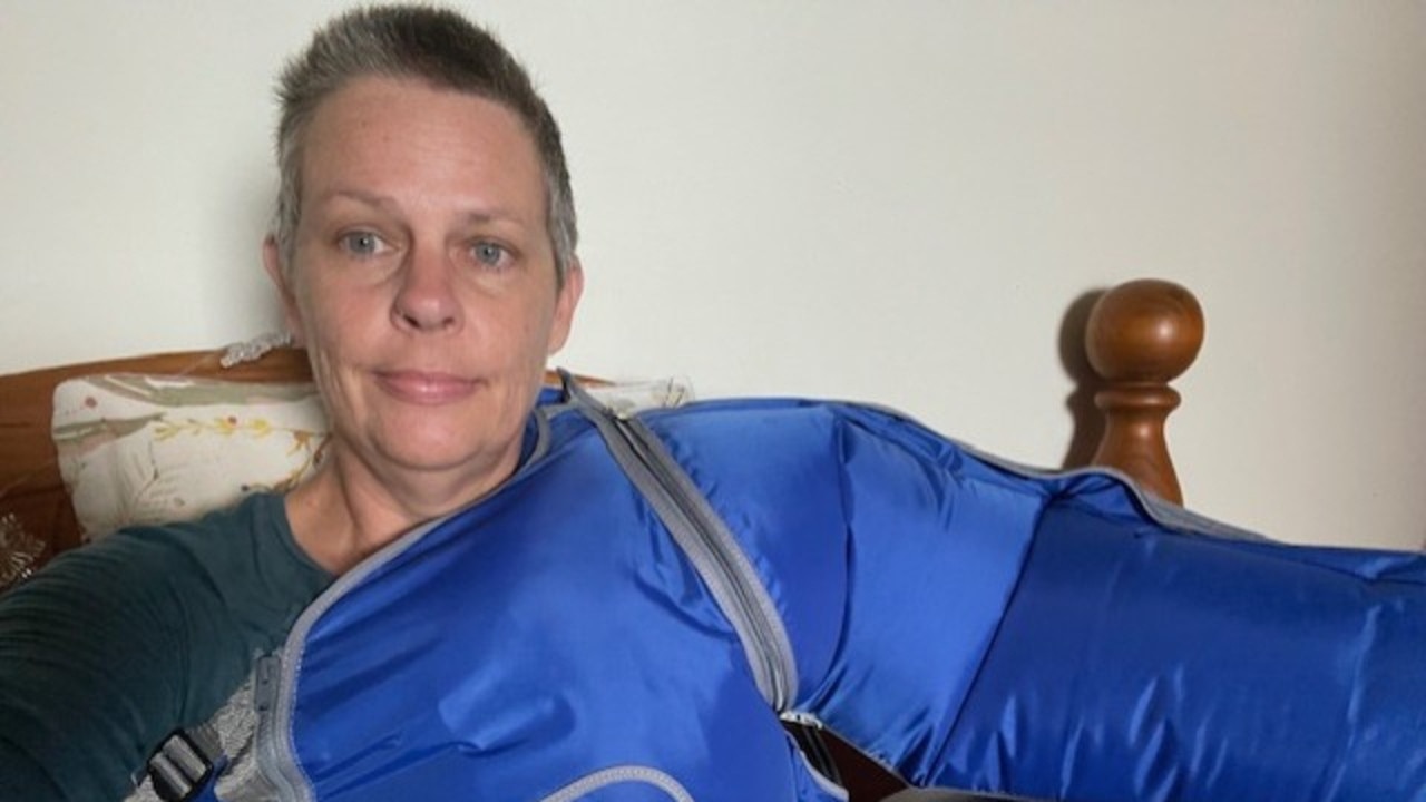 Thursday Island nurse Melissa Haydock contracted lymphedema, a chronic condition that causes limb swelling and disrupts normal bodily functions, as a side effect from life-saving cancer treatment. The most effective treatment method is wearing compression garments and undergoing surgery. Picture: Supplied