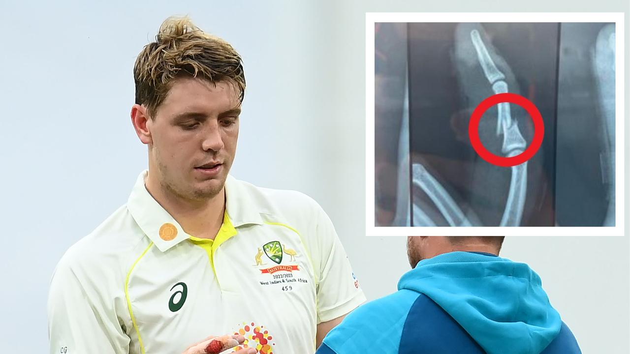 Cameron Green hit Test half century with sickening broken finger