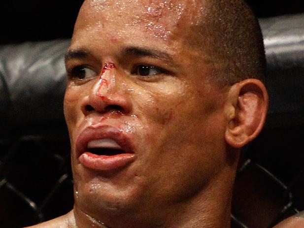 LAS VEGAS, NV - JANUARY 03: Hector Lombard is shown following a three-round welterweight fight against Josh Burkman (R) during the UFC 182 event in the MGM Grand Garden Arena on January 3, 2015 in Las Vegas, Nevada. Lombard won by unanimous decision. (Photo by Steve Marcus/Getty Images)