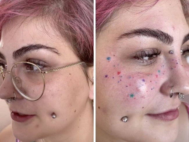 Aussie’s unusual rainbow freckles tattoo