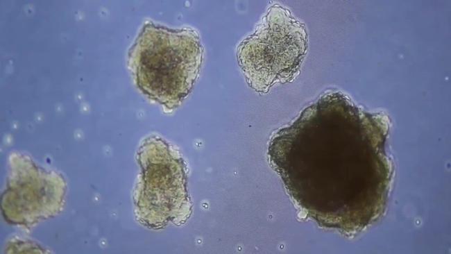 LOOK: Lab-made stem cells up close