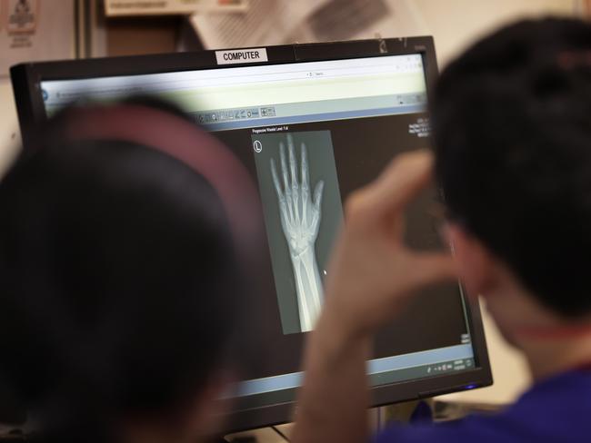 Medical staff look at an X-ray of a hand injury. Picture: David Caird