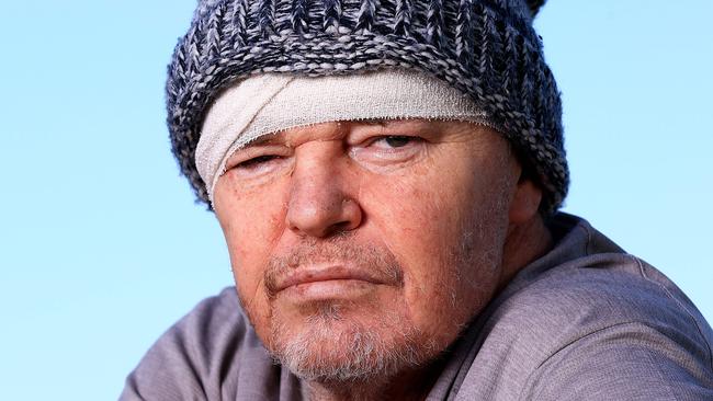 Former NRL player Brett Horsnell is battling chronic traumatic encephalopathy. Picture: Adam Head