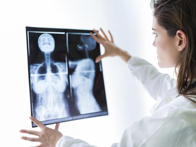 Scans can leave women $1,200 out of pocket. Picture: iStock