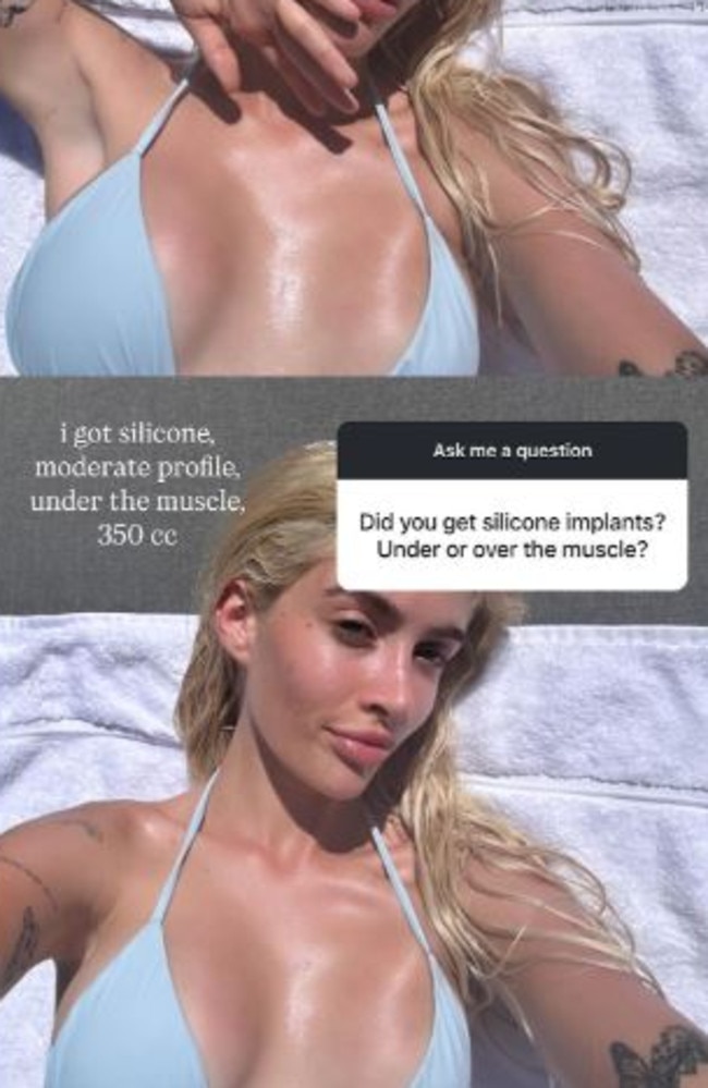 Sami Sheen broke down her exact breast augmentation details after Kylie Jenner did the same. Picture: Instagram