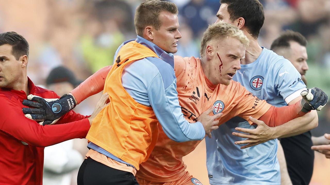 Wounded goalkeeper Thomas Glover is helped from the pitch after a group of Melbourne Victory fans rioted at AAMI Park. Picture: Darrian Traynor/Getty Images