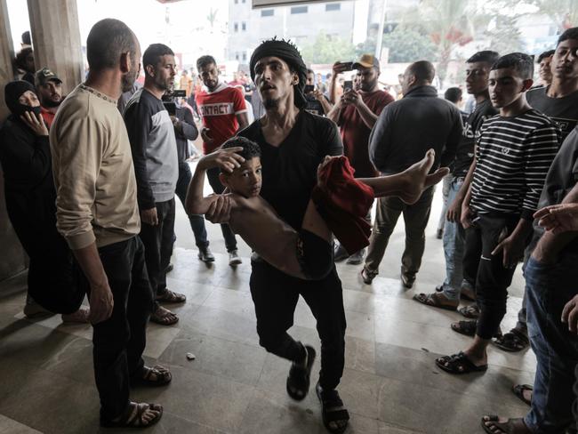 Palestinians injured in Israeli raids arrive at Nasser Medical Hospital. Picture: Getty Images