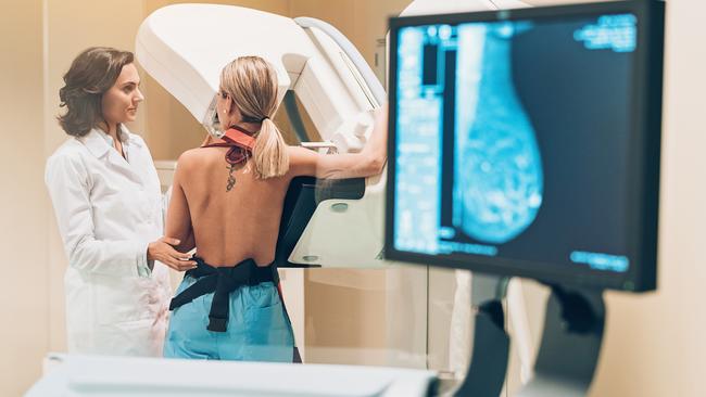 Dense breast tissue appears white or grey on a mammogram. Picture: Getty Images