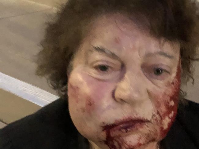 An elderly woman was left bloodied and bruised after a savage attack outside a church in South Yarra, Penelope Katsavos was left bloodied and bruised after the horrific attack.