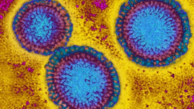 Australia‘s mega virus outbreak