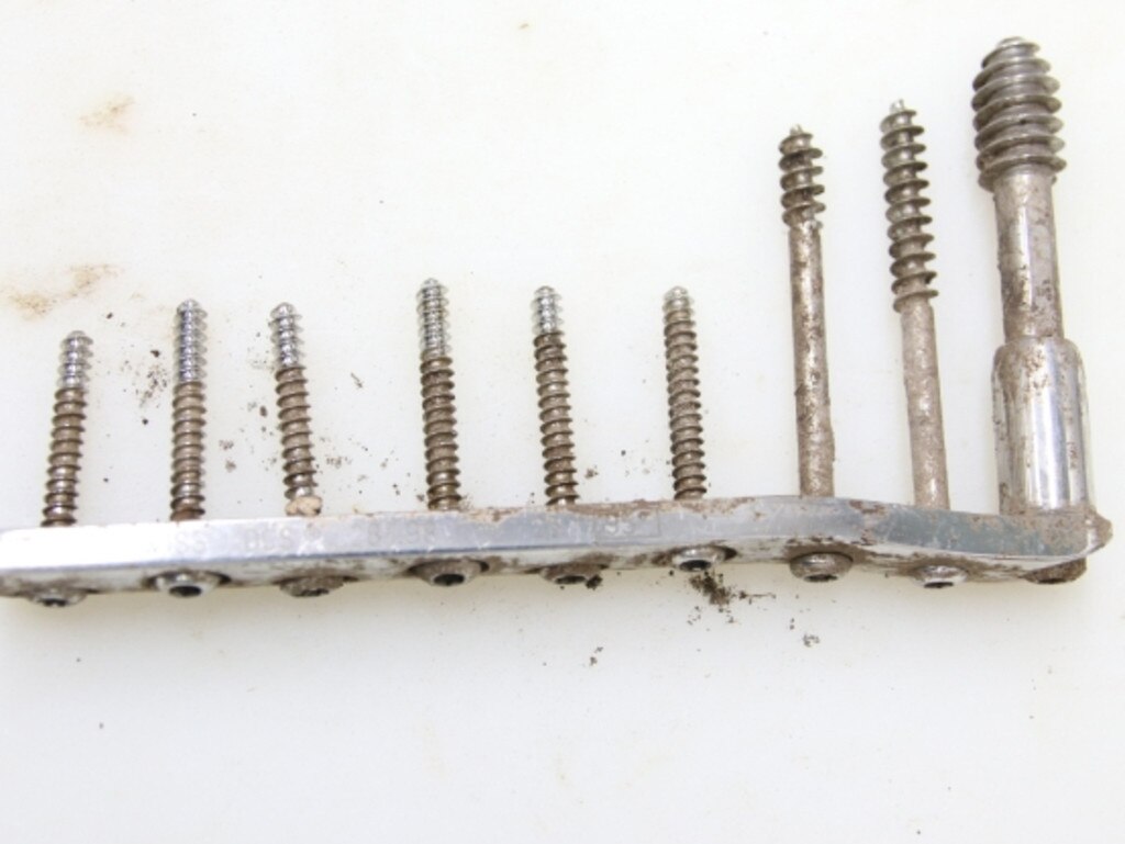 The metal implant with nine screws was found with the unidentified human remains found at Kybong. Picture: Supplied.