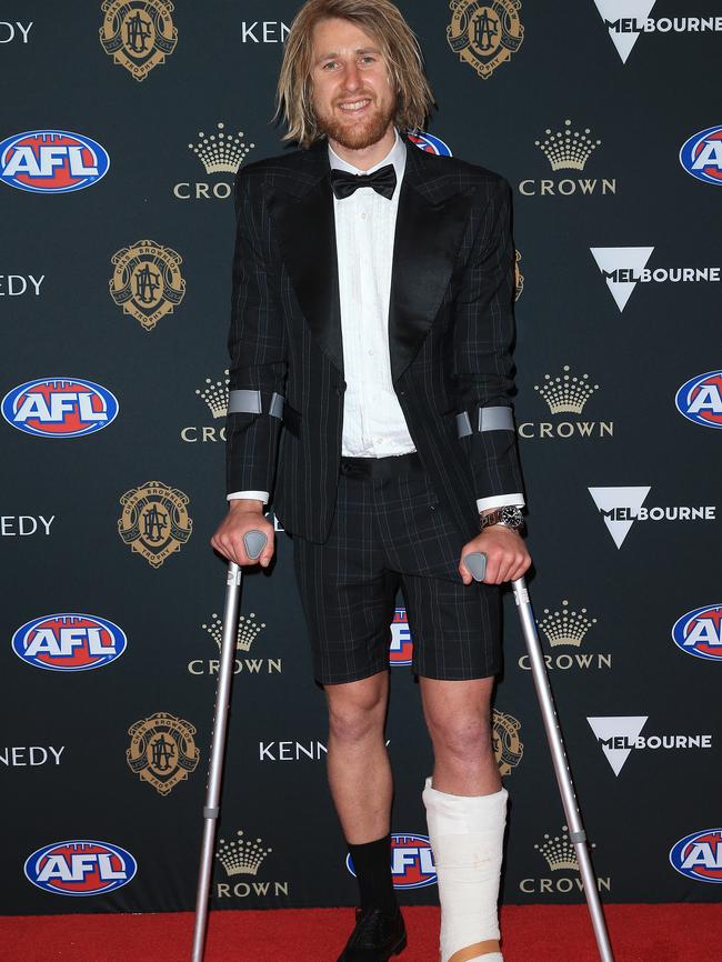 Heppell with his foot in a cast at the Brownlow Medal. Picture: Mark Stewart