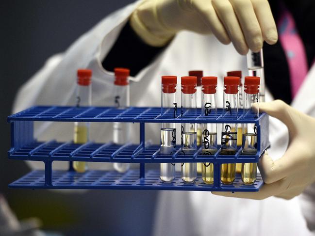 (FILES) In this file photo taken on December 15, 2015 a technician holds urine samples at the French national anti-doping laboratory in Chatenay-Malabry, outside Paris. - The global reduction in travel and human contact over the last year may have played an important role in battling Covid-19 but it has added a new layer of complexity to fighting the doping cheats ahead of the Tokyo Olympics. (Photo by FRANCK FIFE / AFP)