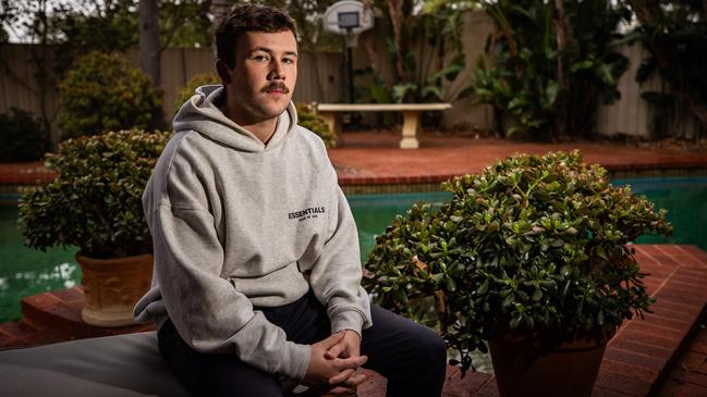 Jake Elias was left with a permanent facial scar after he was attacked by a drunken stranger in the CBD with an axe. Picture: Tom Huntley