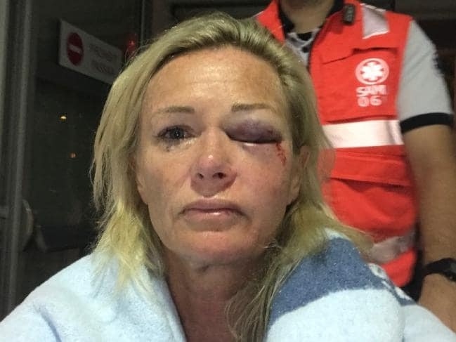 Karen Sadler was the victim of a horrific attack on a Tinder date.