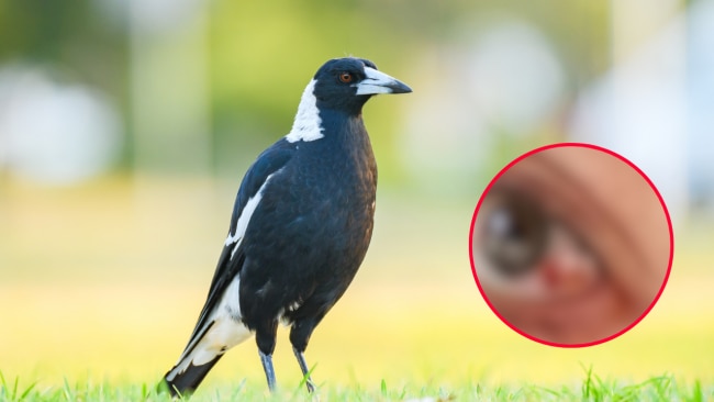 Mum terrified after magpie attacks her eye on walk