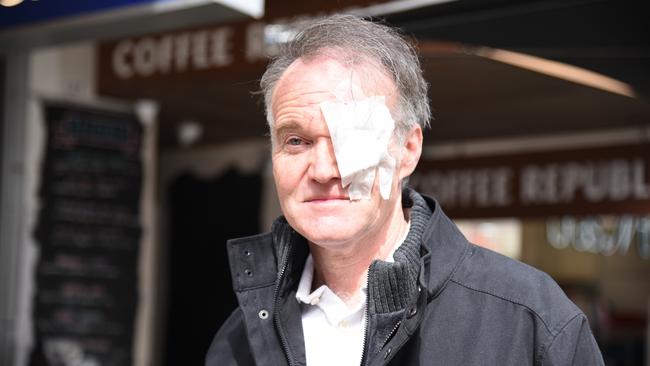 Robin Smith, owner of Brisbane St Mall cafe Coffee Republic. Glass from his contact lens broke in his eye when he was coward punched by a youth offender on the evening of September 12, 2023. Picture: Alex Treacy