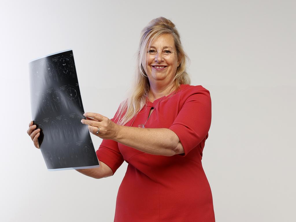 Cerebral palsy researcher Professor Iona Novak. Picture: Jonathan Ng