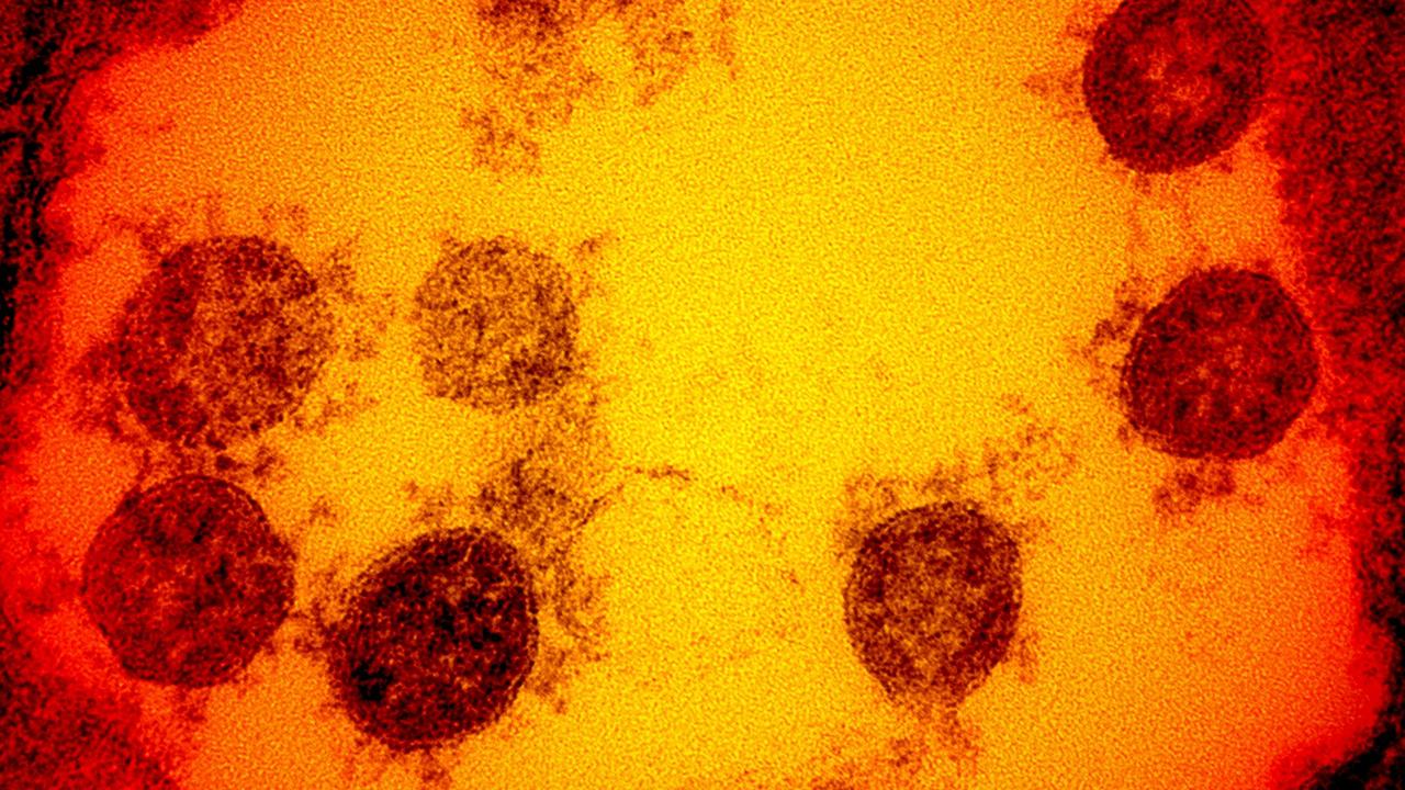 A micrograph of SARS-CoV-2 virus particle. Picture: National Institute of Allergy and Infectious Diseases / AFP.