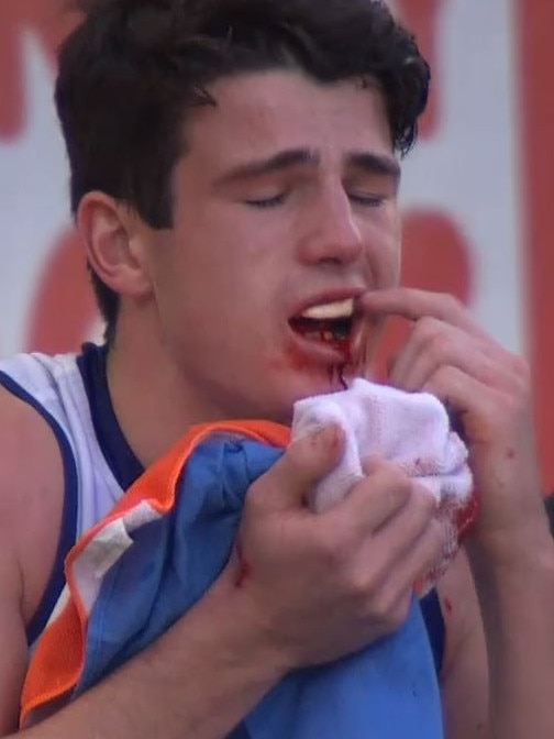 Fremantle Docker Andrew Brayshaw after being hit by Andrew Gaff in Round 20.