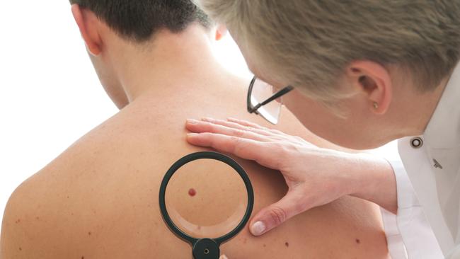 Dermatologist examines a mole of male patient