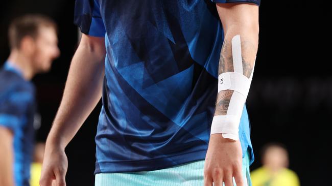 The injured arm of Luka Doncic #77 of Team Slovenia. Picture: Gregory Shamus/Getty Images