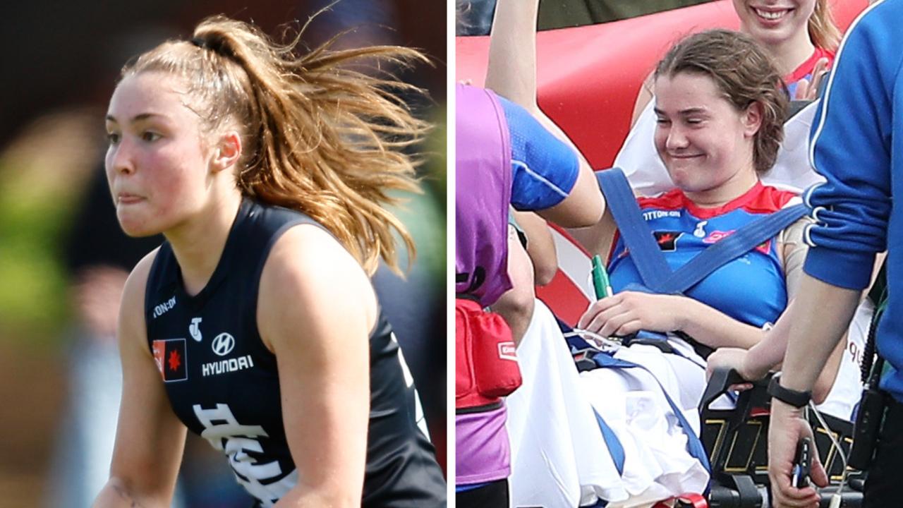 The injury toll is mounting in the AFLW and we're only three rounds in.
