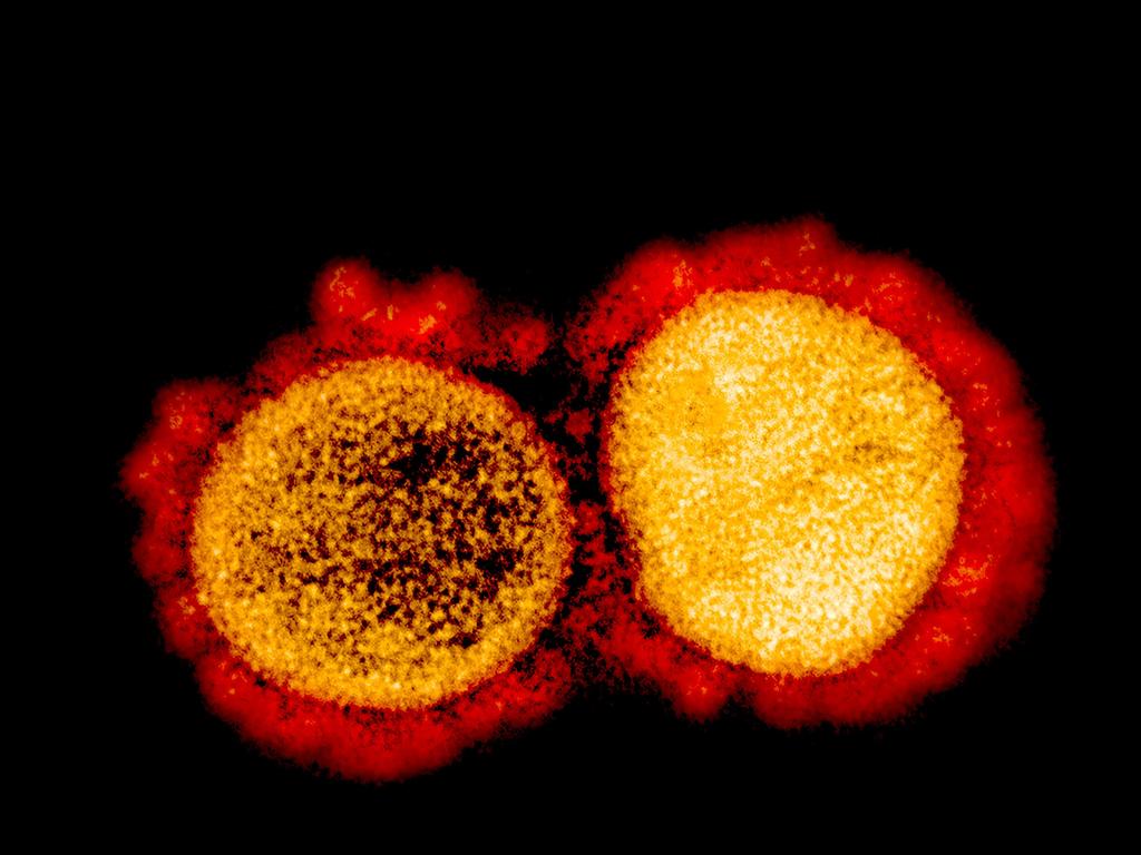 A transmission electron micrograph of SARS-CoV-2 virus particles. Picture: AFP